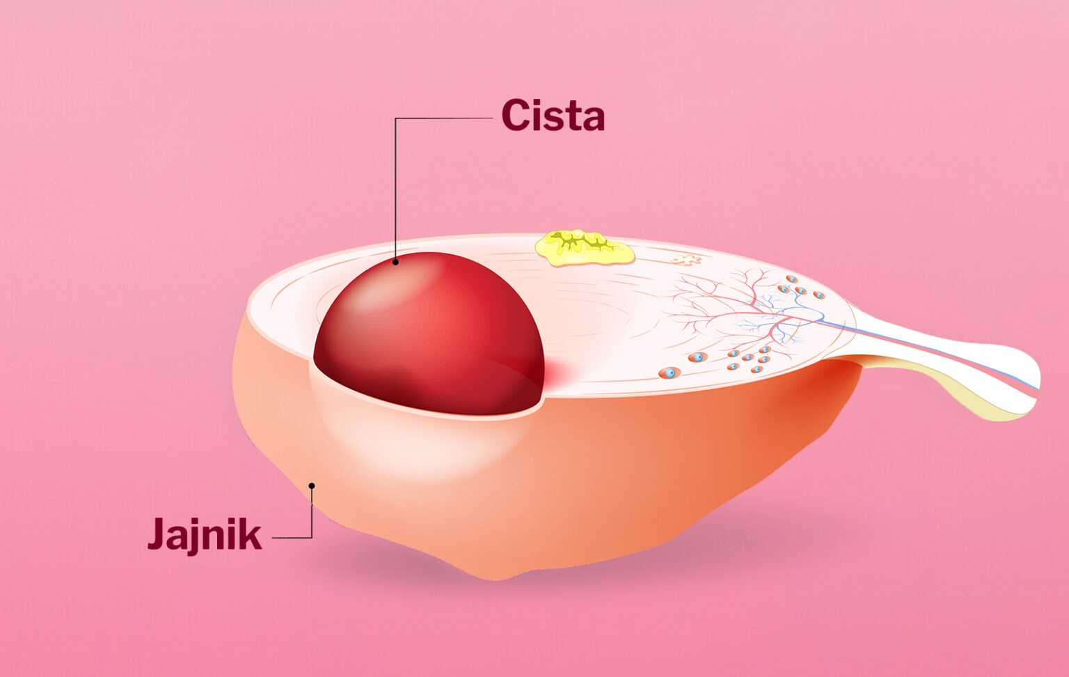 Ciste-na-jajnicima-utiču-na-plodnost:-BabyLab-tablete-za-plodnost-kod-žena-i-njihovo-protiv-upalno-dejstvo