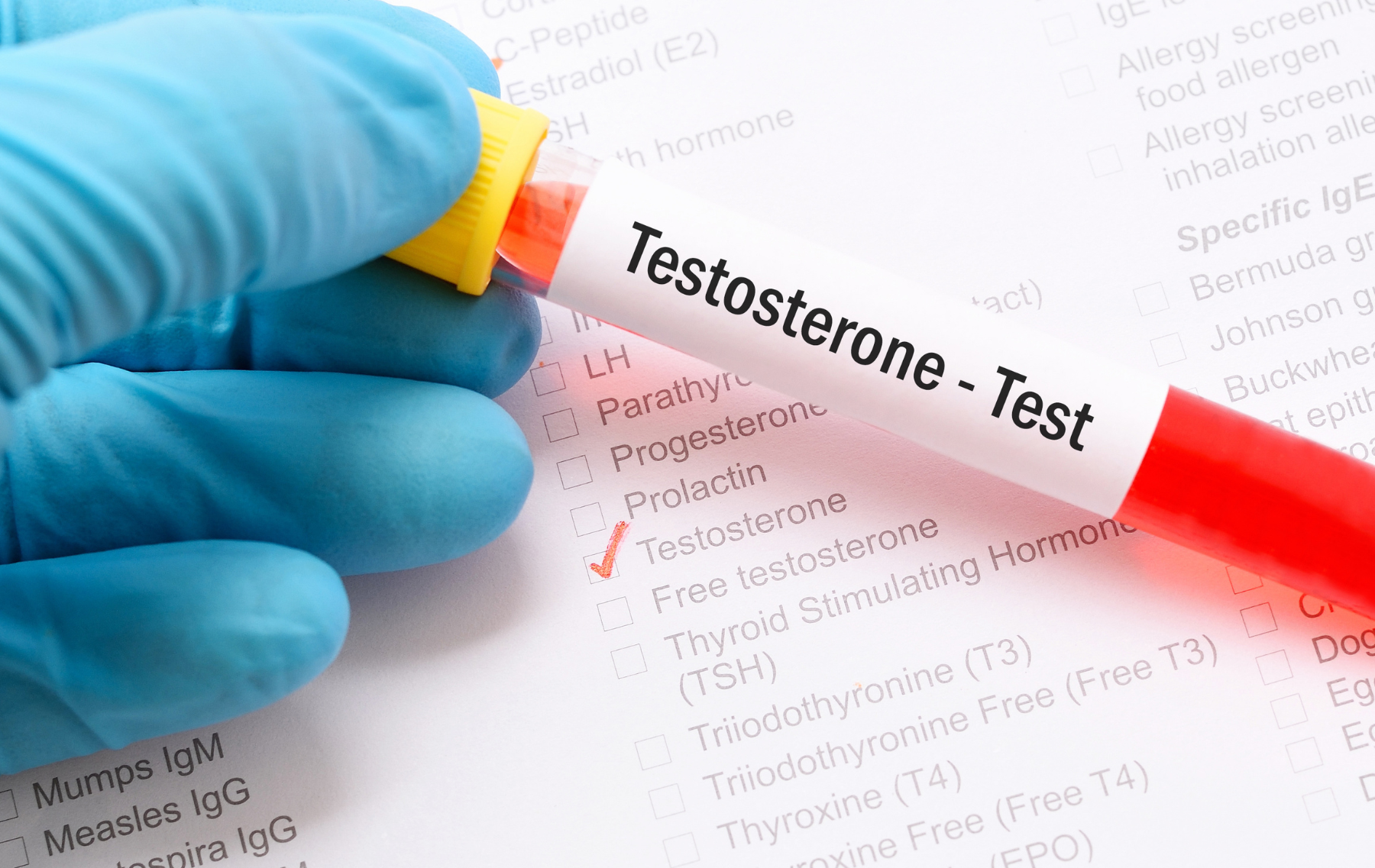 Testosteron i muška plodnost kako hormon utiče na začeće i šta možete uraditi