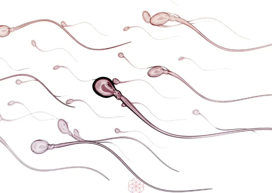Oligo asteno terato azoospermija