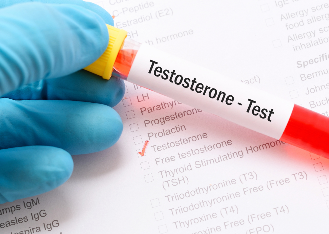 Testosteron i muška plodnost kako hormon utiče na začeće i šta možete uraditi
