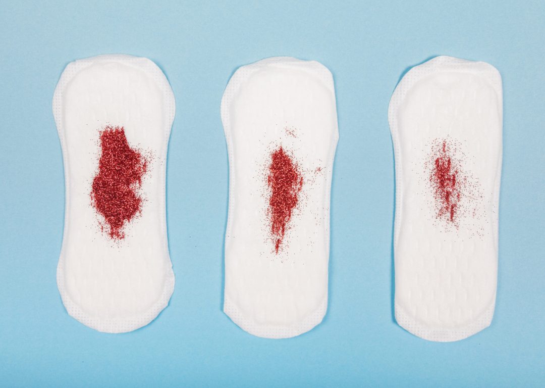 Implantacijsko krvarenje